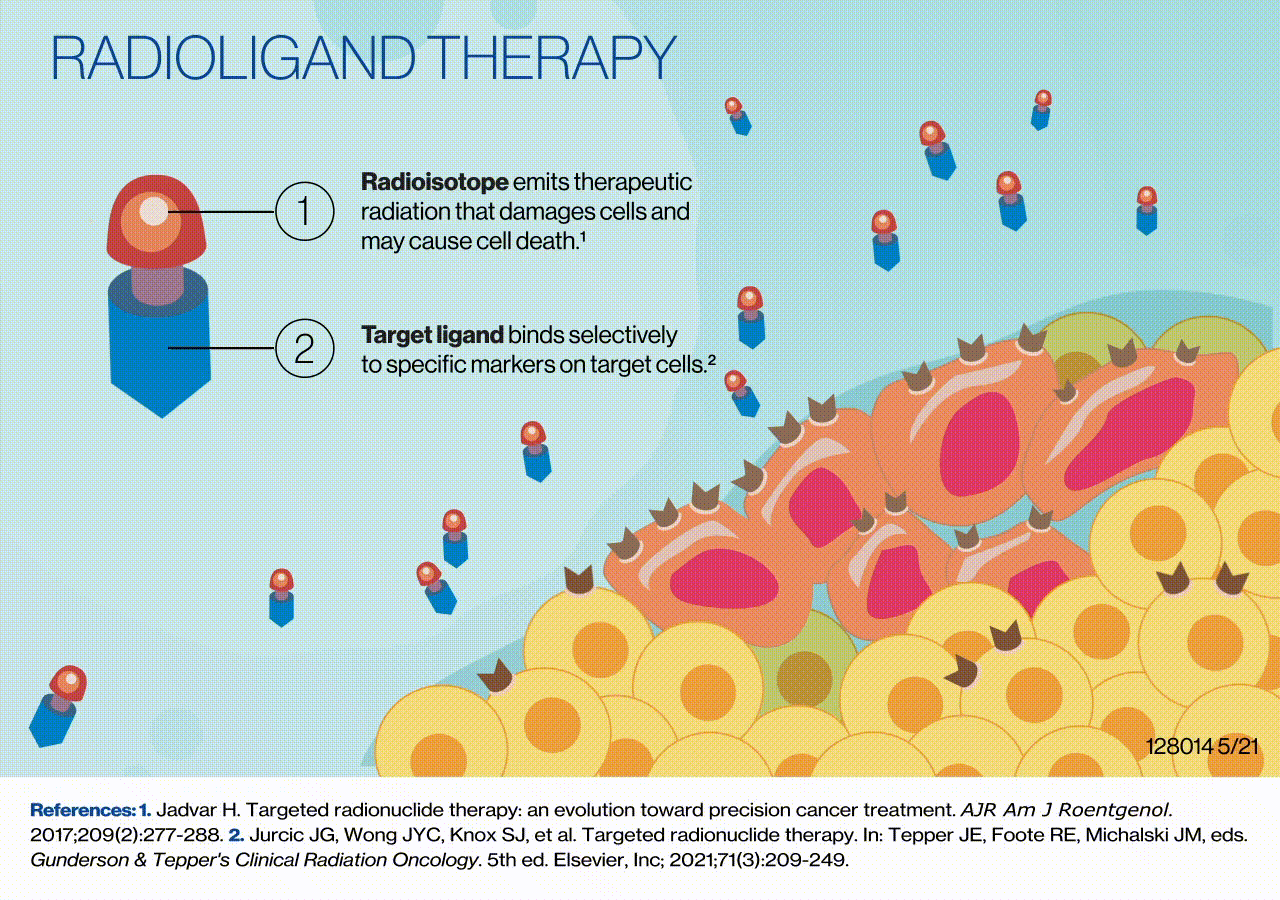 Radioligand therapy explained